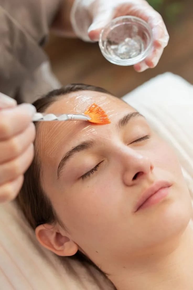 PEELING QUÍMICO — Dra. Yasmin Medrano Avila