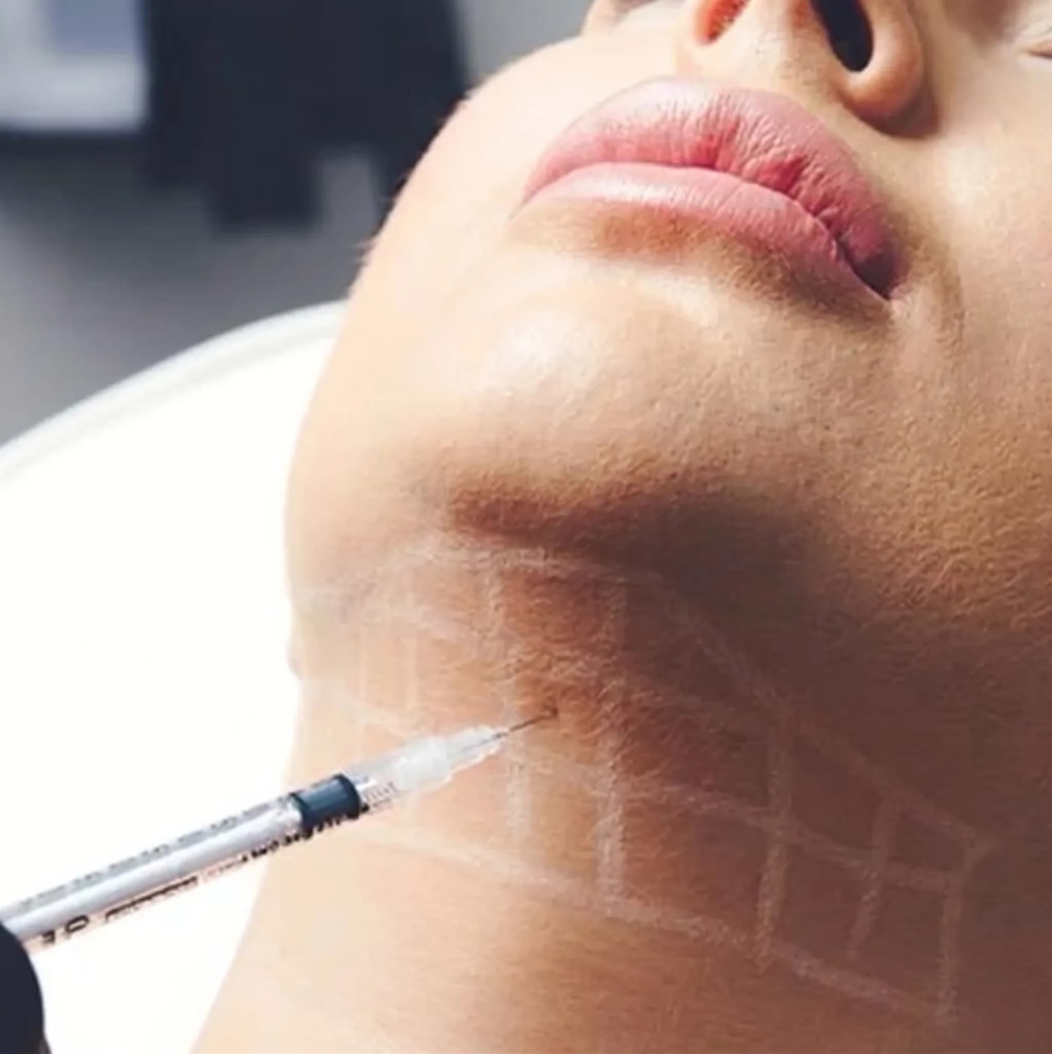 Enzimas Recombinantes — Lipólisis Enzimática